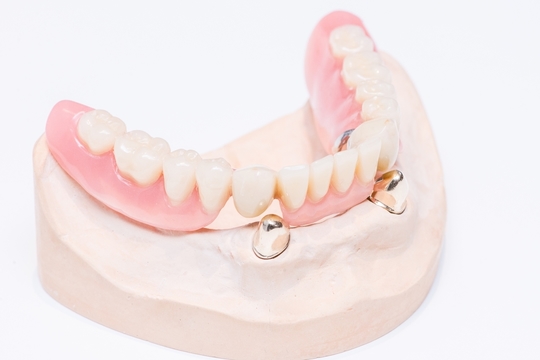 入れ歯 入れ歯（義歯）の治療 - タケヤマ歯科（貝塚市・二色浜駅）